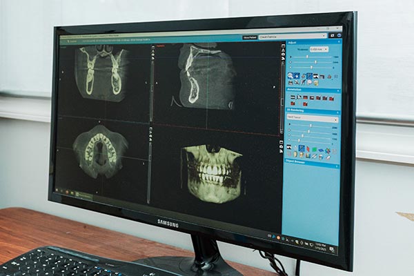 Great Oak Dental Care, Digital Radiographs