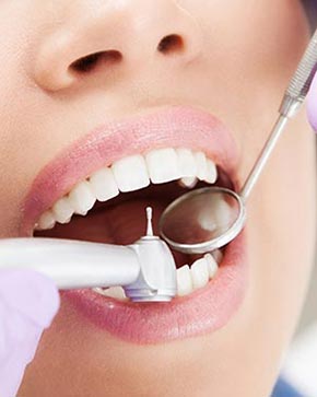 Great Oak Dental Care, General Dental Care